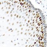 KHDRBS2 Antibody in Immunohistochemistry (Paraffin) (IHC (P))