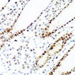 KHDRBS2 Antibody in Immunohistochemistry (Paraffin) (IHC (P))