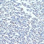 PTBP1 Antibody in Immunohistochemistry (Paraffin) (IHC (P))