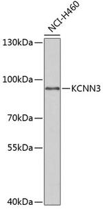 KCNN3 Antibody in Western Blot (WB)