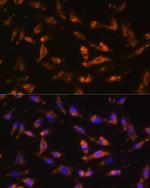 GM-CSF Antibody in Immunocytochemistry (ICC/IF)