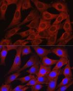 Osteocalcin Antibody in Immunocytochemistry (ICC/IF)