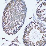 FDFT1 Antibody in Immunohistochemistry (Paraffin) (IHC (P))