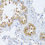 eIF2b beta Antibody in Immunohistochemistry (Paraffin) (IHC (P))