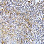 eIF2b beta Antibody in Immunohistochemistry (Paraffin) (IHC (P))