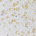 eIF2b beta Antibody in Immunohistochemistry (Paraffin) (IHC (P))