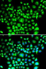 BAP31 Antibody in Immunocytochemistry (ICC/IF)