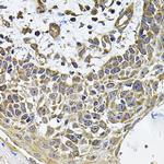 CD275 (B7-H2) Antibody in Immunohistochemistry (Paraffin) (IHC (P))