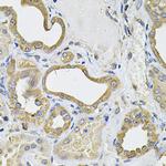 CD275 (B7-H2) Antibody in Immunohistochemistry (Paraffin) (IHC (P))