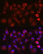 NOX5 Antibody in Immunocytochemistry (ICC/IF)