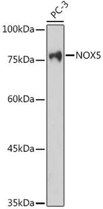 NOX5 Antibody in Western Blot (WB)