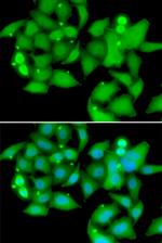 STS1 Antibody in Immunocytochemistry (ICC/IF)