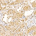 STS1 Antibody in Immunohistochemistry (Paraffin) (IHC (P))