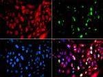 RAP80 Antibody in Immunocytochemistry (ICC/IF)