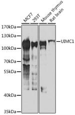 RAP80 Antibody in Western Blot (WB)