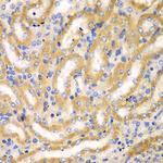 BCAS3 Antibody in Immunohistochemistry (Paraffin) (IHC (P))