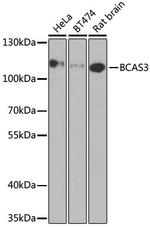 BCAS3 Antibody in Western Blot (WB)