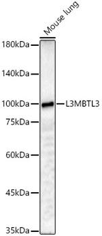 L3MBTL3 Antibody in Western Blot (WB)