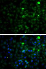 SMYD4 Antibody in Immunocytochemistry (ICC/IF)