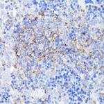 SMYD4 Antibody in Immunohistochemistry (Paraffin) (IHC (P))