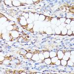 SMYD4 Antibody in Immunohistochemistry (Paraffin) (IHC (P))