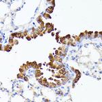 SMYD4 Antibody in Immunohistochemistry (Paraffin) (IHC (P))