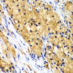 CAPG Antibody in Immunohistochemistry (Paraffin) (IHC (P))