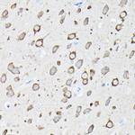 EEF1A2 Antibody in Immunohistochemistry (Paraffin) (IHC (P))