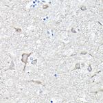 EEF1A2 Antibody in Immunohistochemistry (Paraffin) (IHC (P))