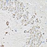 EEF1A2 Antibody in Immunohistochemistry (Paraffin) (IHC (P))