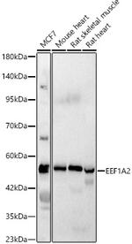 EEF1A2 Antibody in Western Blot (WB)