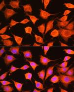 PHKG2 Antibody in Immunocytochemistry (ICC/IF)