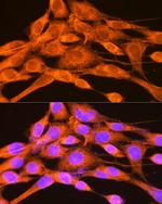 PHKG2 Antibody in Immunocytochemistry (ICC/IF)