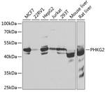 PHKG2 Antibody in Western Blot (WB)