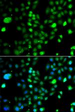 PRDM5 Antibody in Immunocytochemistry (ICC/IF)