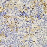 PRDM5 Antibody in Immunohistochemistry (Paraffin) (IHC (P))