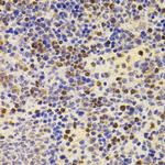 PRDM5 Antibody in Immunohistochemistry (Paraffin) (IHC (P))