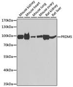 PRDM5 Antibody in Western Blot (WB)