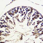 ATG10 Antibody in Immunohistochemistry (Paraffin) (IHC (P))