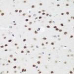 AEBP2 Antibody in Immunohistochemistry (Paraffin) (IHC (P))