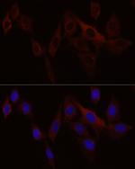 STIM1 Antibody in Immunocytochemistry (ICC/IF)