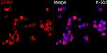 STIM1 Antibody in Immunocytochemistry (ICC/IF)