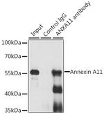 Annexin A11 Antibody in Immunoprecipitation (IP)