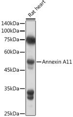 Annexin A11 Antibody in Western Blot (WB)