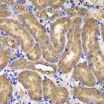 NME2 Antibody in Immunohistochemistry (Paraffin) (IHC (P))