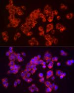 Furin Antibody in Immunocytochemistry (ICC/IF)