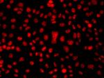 hnRNP A1 Antibody in Immunocytochemistry (ICC/IF)