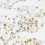 hnRNP A1 Antibody in Immunohistochemistry (Paraffin) (IHC (P))