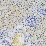 hnRNP A1 Antibody in Immunohistochemistry (Paraffin) (IHC (P))