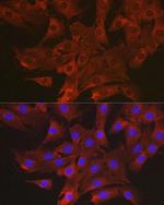 CCL3 Antibody in Immunocytochemistry (ICC/IF)